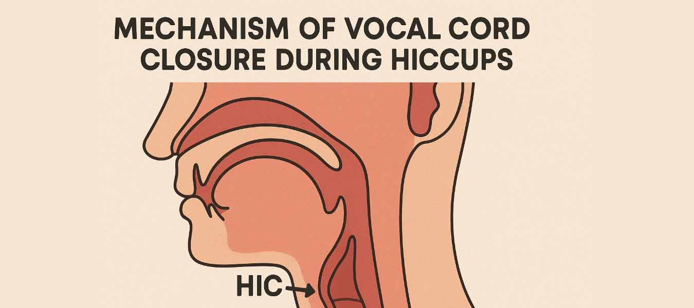 Mekanisme penutupan pita suara saat cegukan