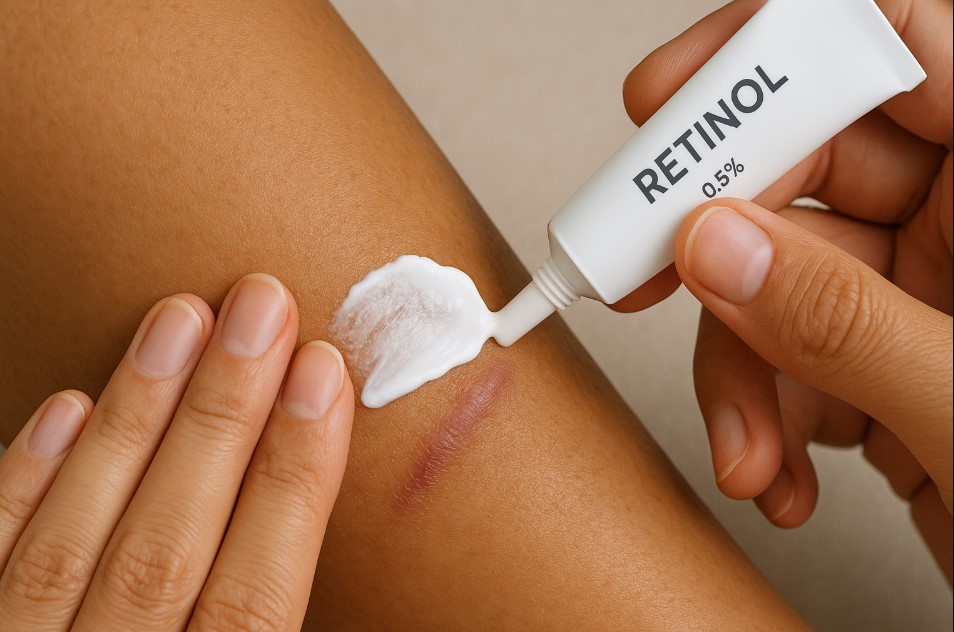 Retinol untuk bekas luka